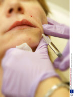 Woman having Botex injections