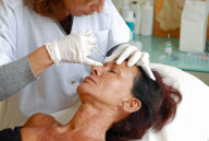 France Miracles of Plastic Surgery