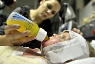 3-year-old who suffered 80% burns recovers after receives groundbreaking artificially-grown 'cloned' skin grafts, South Africa - 26 Jun 2012