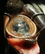 First UK cataract operation on an elephant, Paignton Zoo, Devon, Britain - 20 Sep 2012