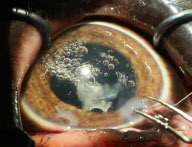 First UK cataract operation on an elephant, Paignton Zoo, Devon, Britain - 20 Sep 2012