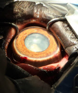 First UK cataract operation on an elephant, Paignton Zoo, Devon, Britain - 20 Sep 2012