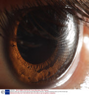 Extreme close ups of the human eye by Suren Manvelyan, Armenia - Sep 2010