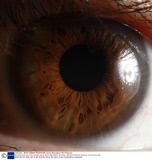 Extreme close ups of the human eye by Suren Manvelyan, Armenia - Sep 2010