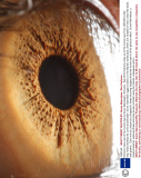 Extreme close ups of the human eye by Suren Manvelyan, Armenia - Sep 2010