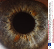 Extreme close ups of the human eye by Suren Manvelyan, Armenia - Sep 2010