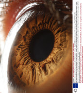 Extreme close ups of the human eye by Suren Manvelyan, Armenia - Sep 2010