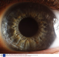 Extreme close ups of the human eye by Suren Manvelyan, Armenia - Sep 2010