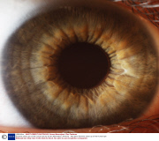 Extreme close ups of the human eye by Suren Manvelyan, Armenia - Sep 2010