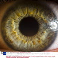 Extreme close ups of the human eye by Suren Manvelyan, Armenia - Sep 2010
