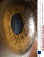 Extreme close ups of the human eye by Suren Manvelyan, Armenia - Sep 2010