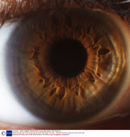 Extreme close ups of the human eye by Suren Manvelyan, Armenia - Sep 2010