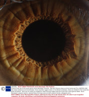Extreme close ups of the human eye by Suren Manvelyan, Armenia - Sep 2010