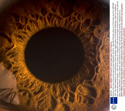 Extreme close ups of the human eye by Suren Manvelyan, Armenia - Sep 2010