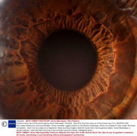 Extreme close ups of the human eye by Suren Manvelyan, Armenia - Sep 2010