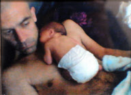 Two-month-old baby dies after kiss from father infects him with the herpes simplex cold sore virus, Merseyside, Britain - Dec 2012