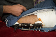 Pflegestation für verletzte Syrer in Kilis