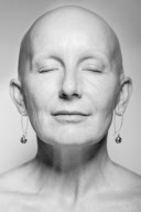 Photographer creates The Alopecia Series to raise awareness through striking images, Britain - May 2013