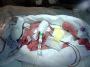 Grosszügig - Lottogewinner finanzieren Operation