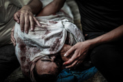 Palestinian Territories: Israeli airstrikes on Gaza