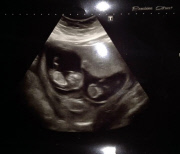 Mother gives birth to four babies within space of nine months, London, Britain - 22 Jul 2014