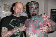 King Of Ink Land HAs nipple removed in the name of science