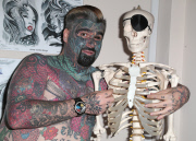 King Of Ink Land HAs nipple removed in the name of science