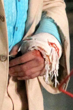 *EXCLUSIVE* Ryan Gosling gets banged up on the set of "The Nice Guys"