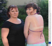 Girl suffers severe burns after six minutes on sunbed at unmanned salon, Swansea, Wales, Britain - Jun 2010
