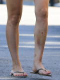 Kaley Cuoco takes care of her errands with a large bruise on her leg