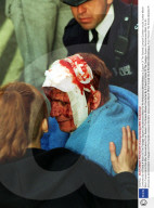 Comforted By A Friend A Victim Of The Trafalgar Square Disturbances Waits For An Ambulance.demonstration In Support Of The Sacked Liverpool Dockers 'social Justice March' Which Turned Into A Riot After Demonstrators From Reclaim The Streets Attacke