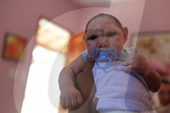 NEWS - Kampf gegen das Zika Virus in Südamerika