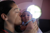 NEWS - Zika Virus: 1581 Babys mit Mikrozephalie behinderung seit Oktober 2015 