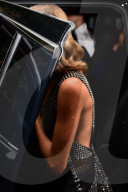PEOPLE - Cara Delevingne leidet von einer Psoriasis-Ausbruch 