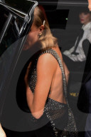 PEOPLE - Cara Delevingne leidet von einer Psoriasis-Ausbruch 