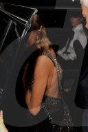 PEOPLE - Cara Delevingne leidet von einer Psoriasis-Ausbruch 