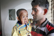REPORTAGE -  Leidet an einer Krankheit: Bayezid Shikdar (4) sieht aus wie ein Greis