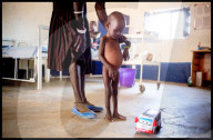 Action Against Hunger-South Sudan
