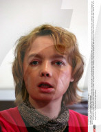 AMIENS : Isabelle Dinoire Face transplant.