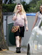 EXC - DEAD OR ALIVE SINGER PETE BURNS LOOKS UNRECOGNISABLE