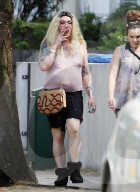 EXC - DEAD OR ALIVE SINGER PETE BURNS LOOKS UNRECOGNISABLE