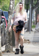 EXC - DEAD OR ALIVE SINGER PETE BURNS LOOKS UNRECOGNISABLE