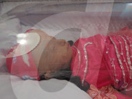 FEATURE - Philippinen: Älteste Progeria Patientin mit 19 Jahren gestorben