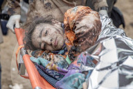 NEWS - Syrien: Verletzte werden in ein Feld-Spital gebracht