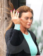 EXKLUSIV -  Rangezoomt: Caitlyn Jenner's neues Gesicht aus der Nähe betrachtet