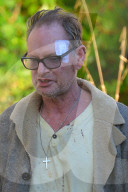 EXKLUSIV - Fussballer Paul Gascoigne mit einem grossen Pflaster im Gesicht