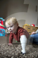 FEATURE - Vater kreiert Armprothese für seinen Sohn