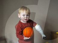 FEATURE - Vater kreiert Armprothese für seinen Sohn