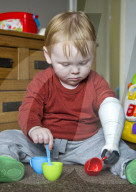 FEATURE - Vater kreiert Armprothese für seinen Sohn