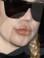 PEOPLE - "Duckmouth" - Hat sich Khloe Kardashian die Lippen aufgespritzt?